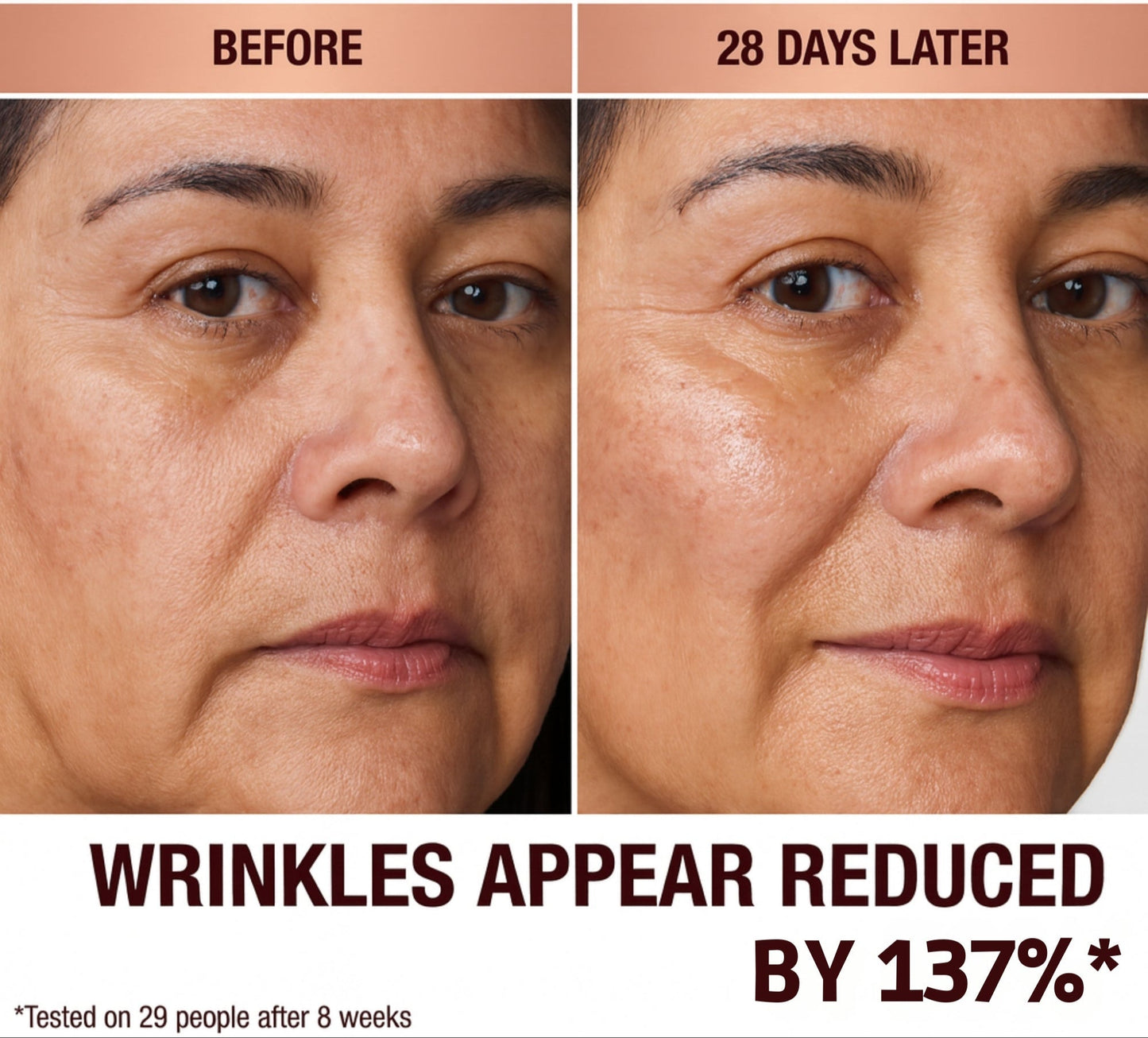 Orvani Calcium Multi Balm - Wrinkles, Dark Spots, Sagging