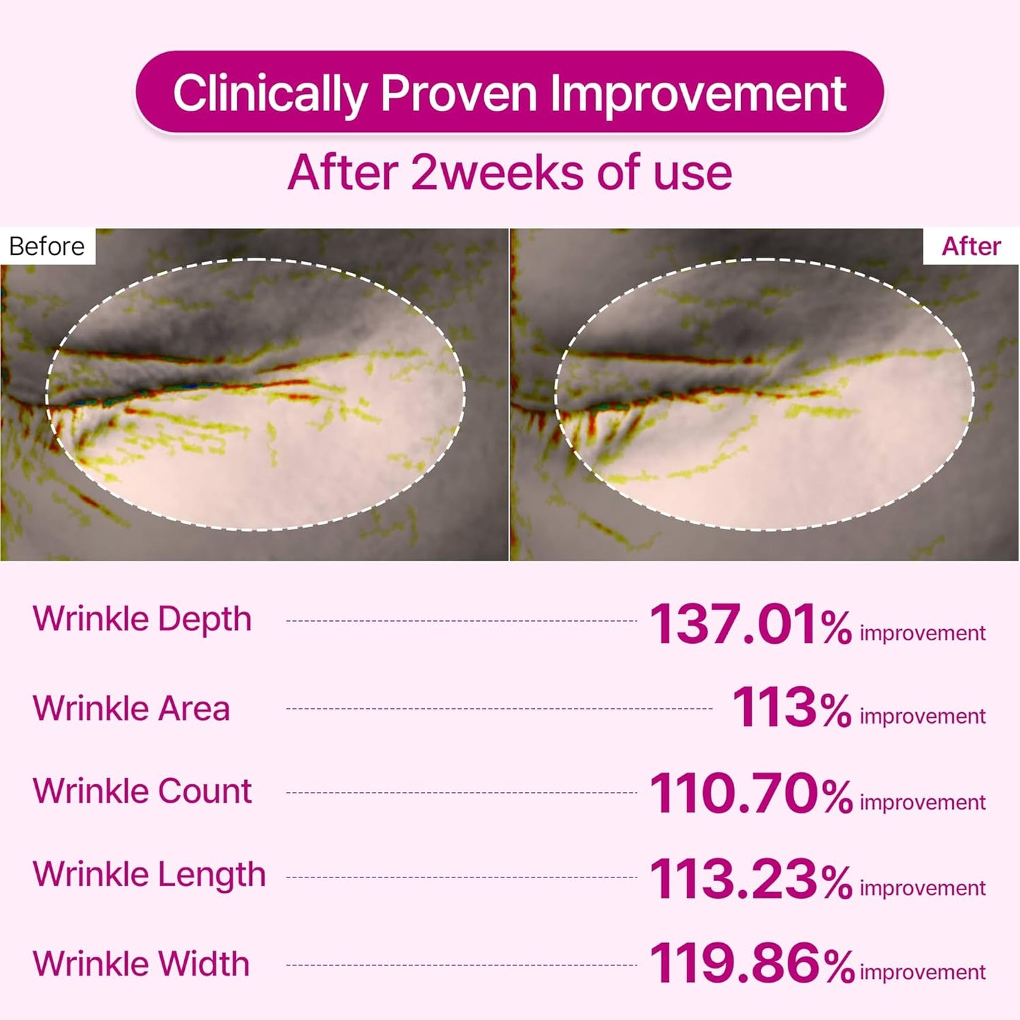 Orvani Calcium Multi Balm - Wrinkles, Dark Spots, Sagging