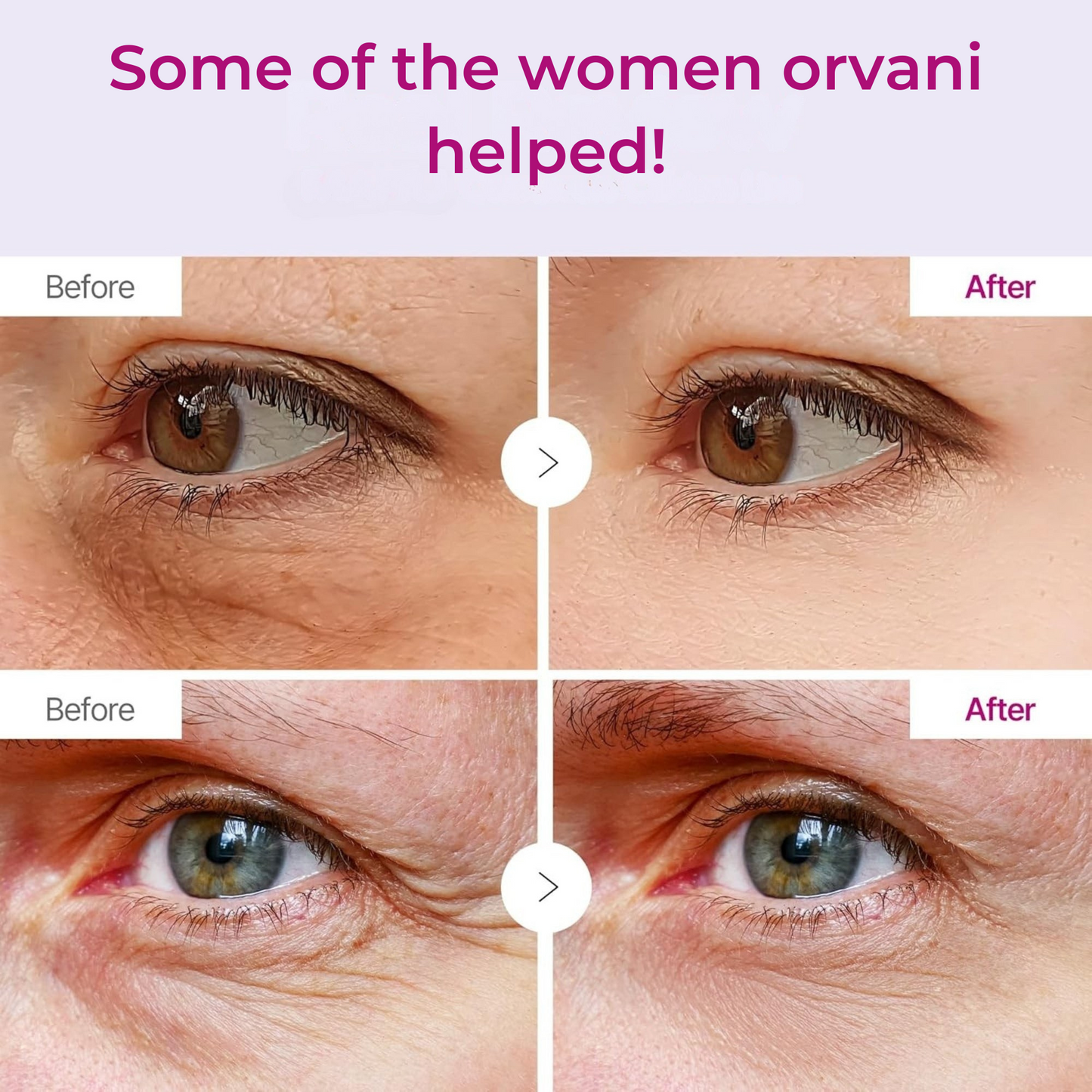 Orvani Calcium Multi Balm - Wrinkles, Dark Spots, Sagging