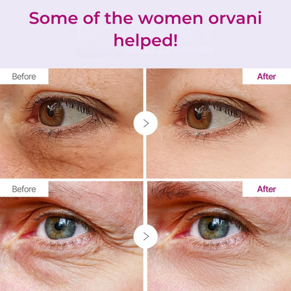 Orvani Calcium Multi Balm - Wrinkles, Dark Spots, Sagging